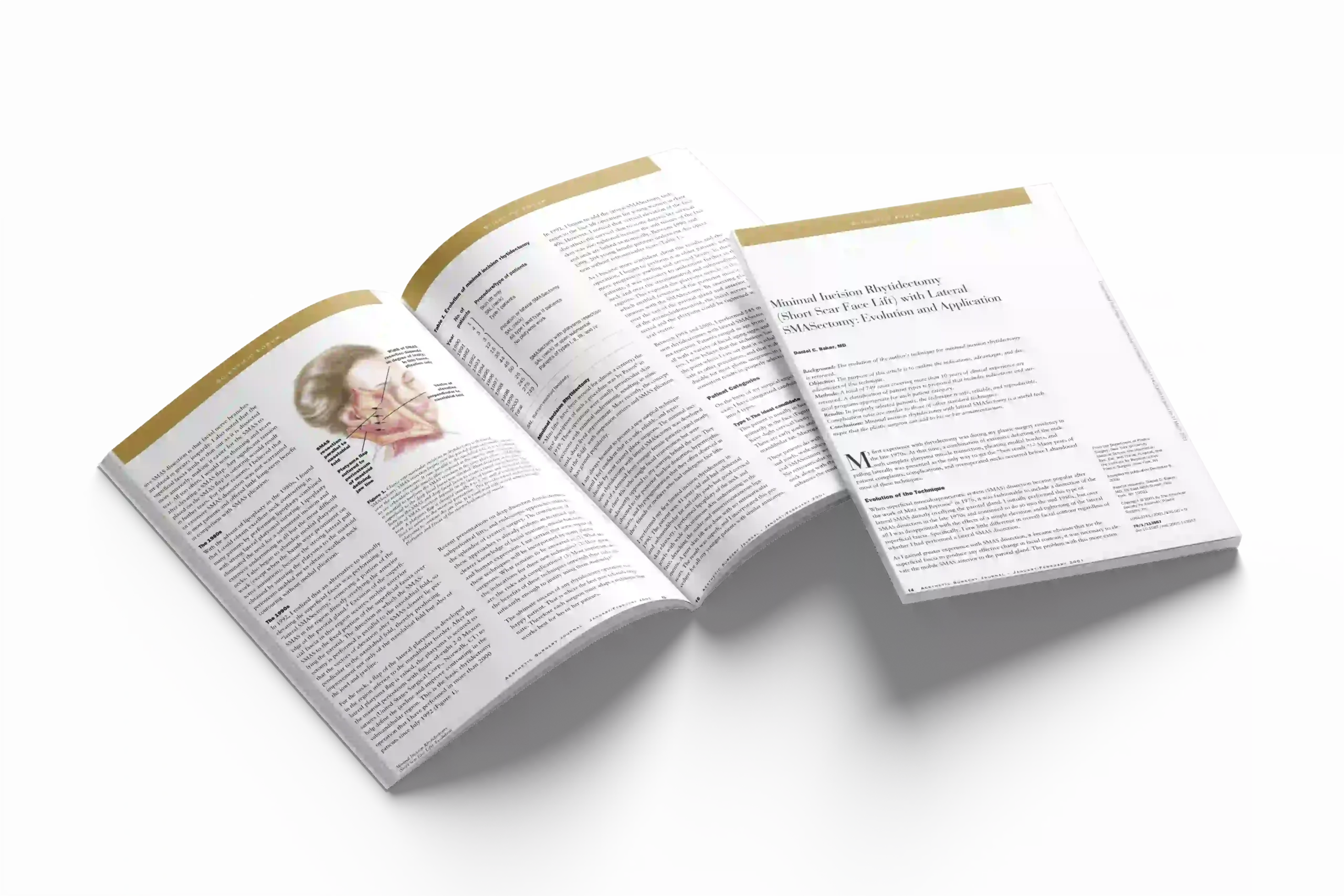 Minimal Incision Rhytidectomy (Short Scar Face Lift) with Lateral SMASectomy: Evolution and Application