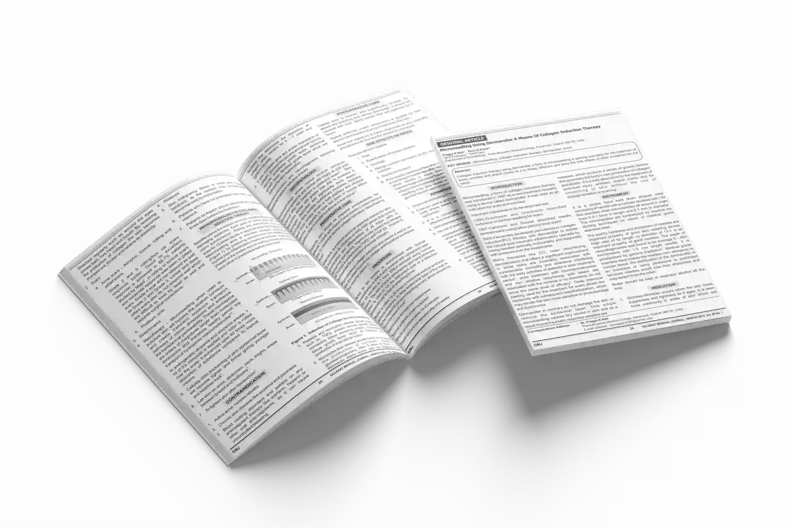 Microneedling Using Dermaroller A Means Of Collagen Induction Therapy