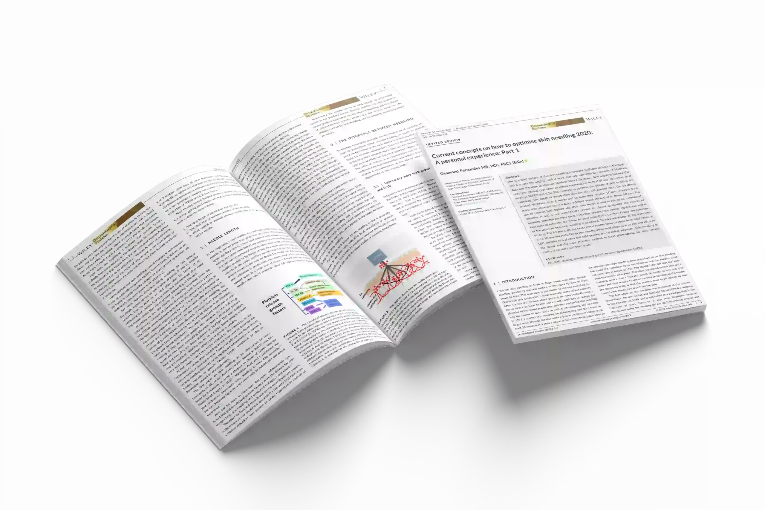 Current concepts on how to optimise skin needling 2020: A personal experience: Part 1