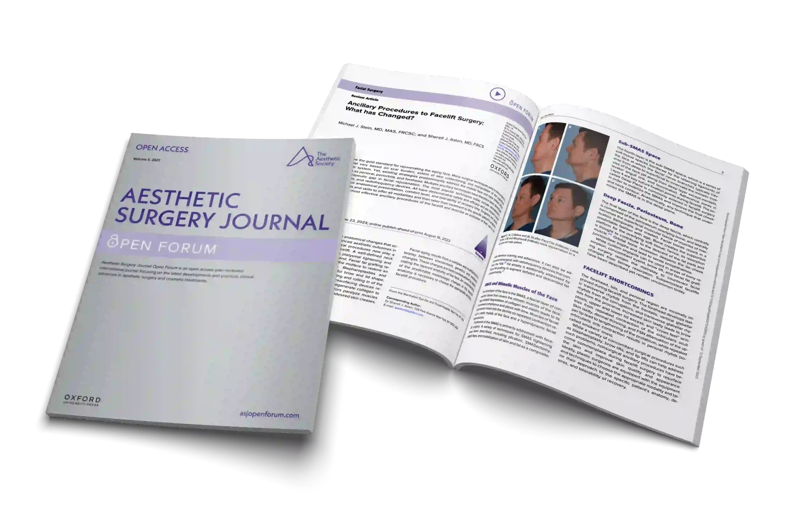 Ancillary Procedures to Facelift Surgery: What has Changed?