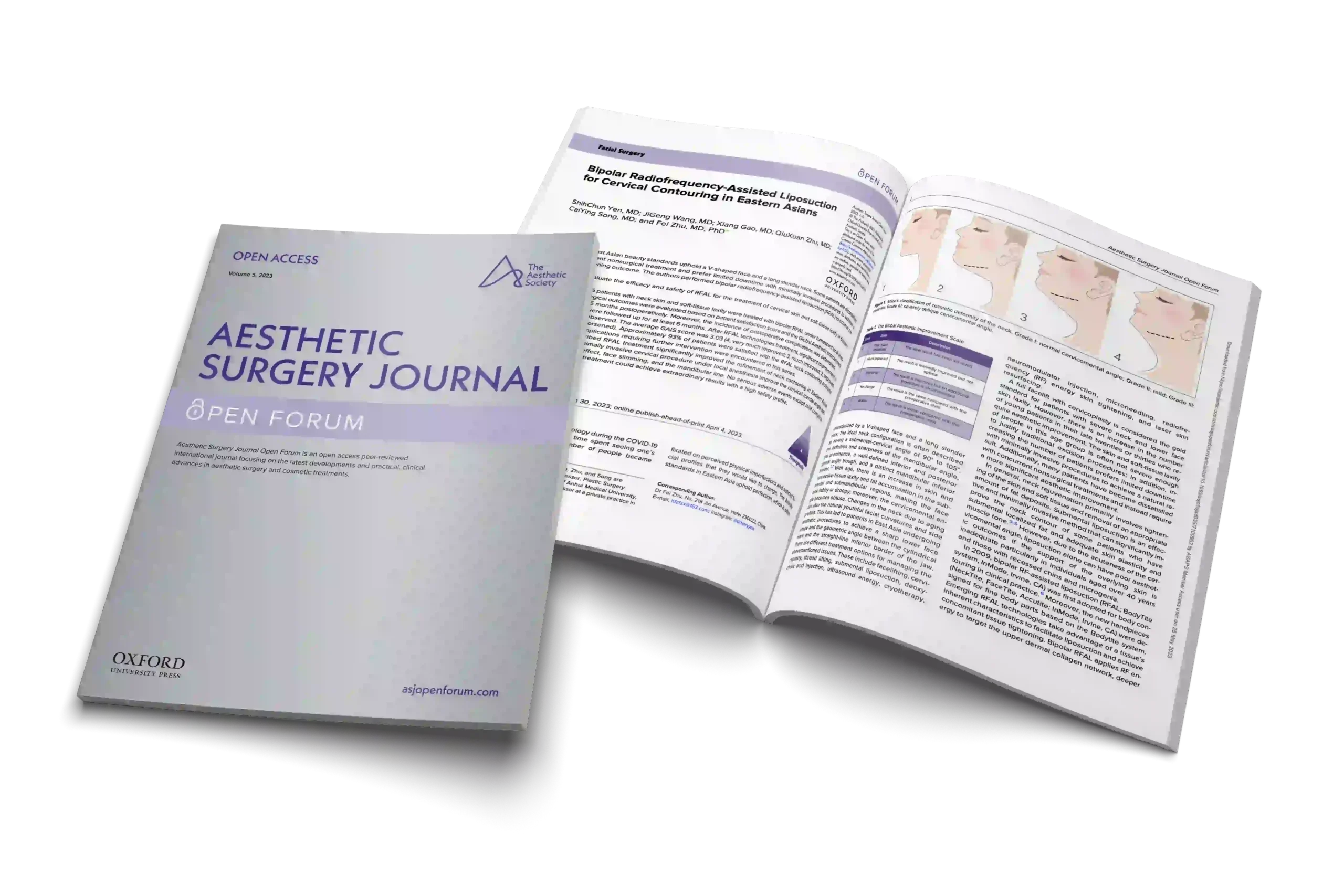 RFAL for Cervical Contouring in Eastern Asians