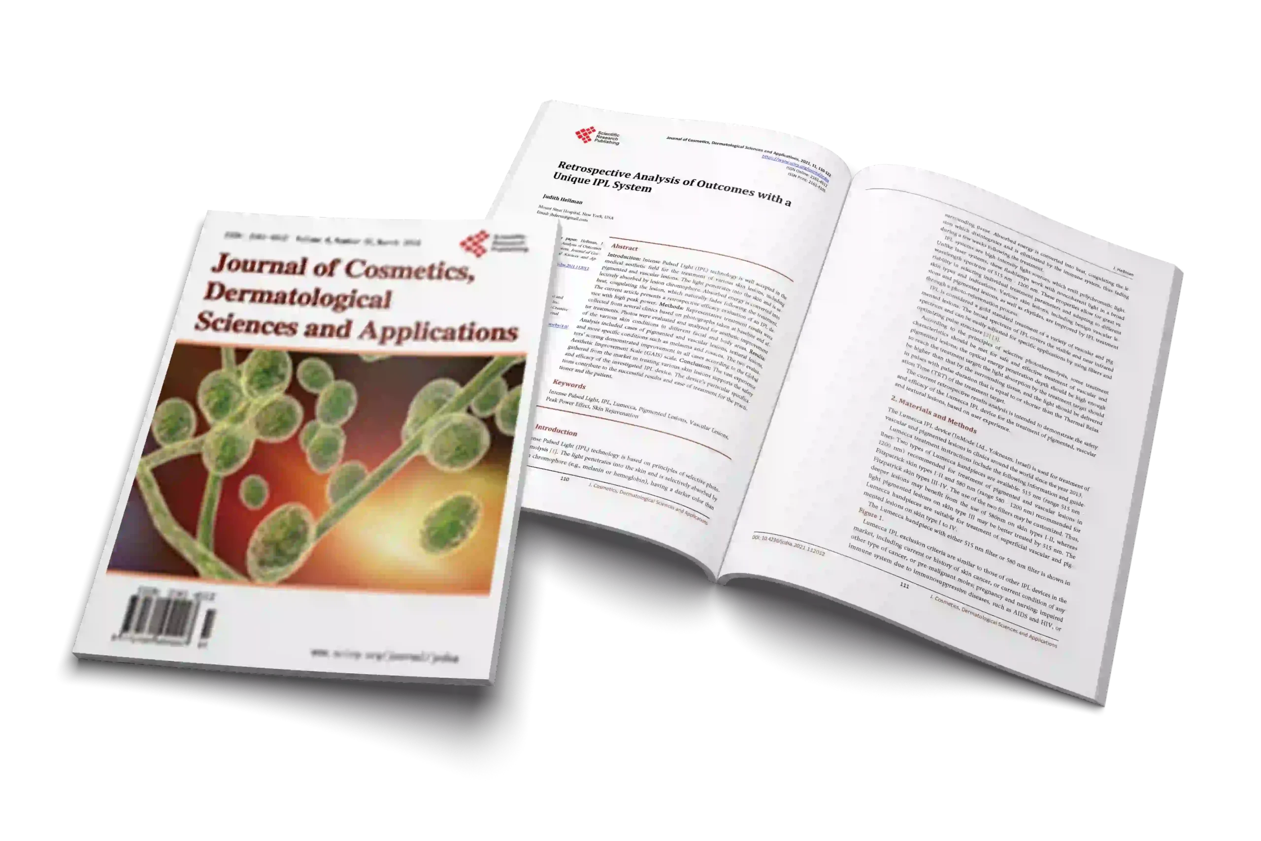 Retrospective Analysis of Outcomes with a Unique IPL System